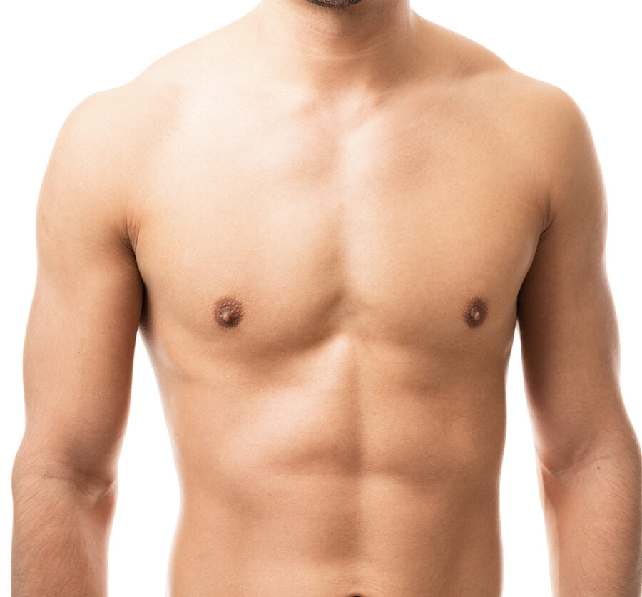 depilación laser piernas masculinas soprano titanium depimed