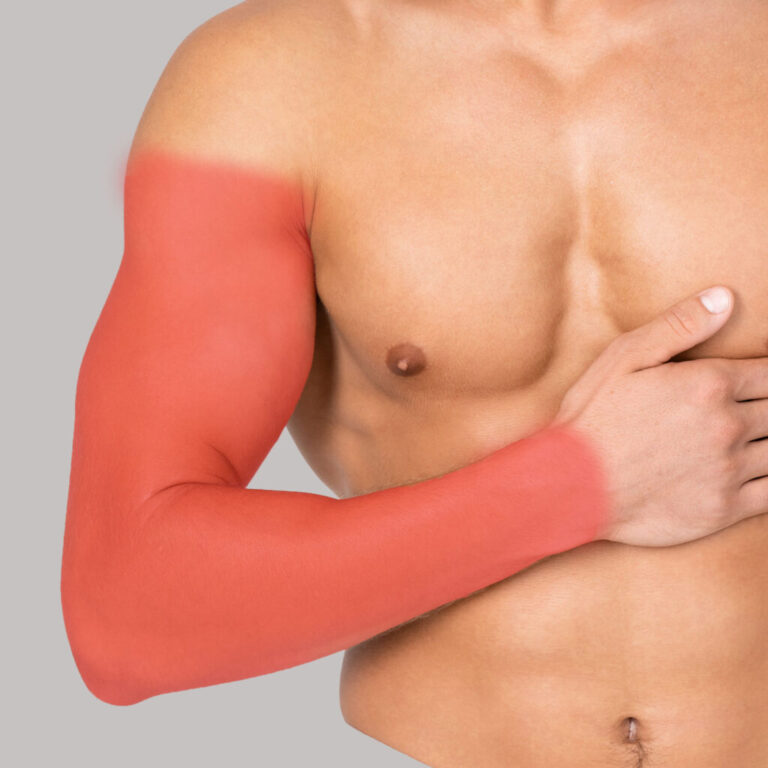 brazo_completo_hombre-1024x1024