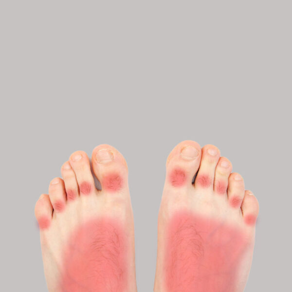 dedos_y_pies_hombres-600x600